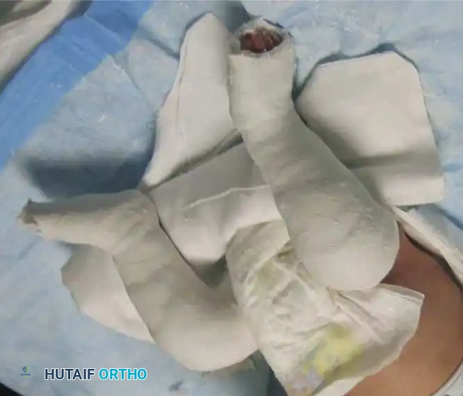 Hutaifortho's Orthopaedic Diagram