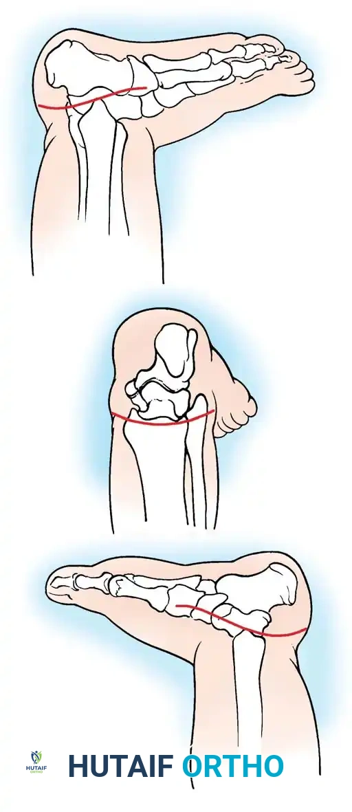 Hutaifortho's Orthopaedic Diagram