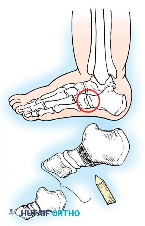 Hutaifortho's Orthopaedic Diagram