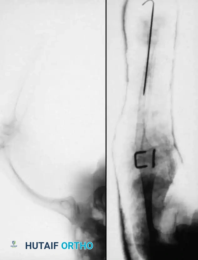 Hutaifortho's Orthopaedic Diagram