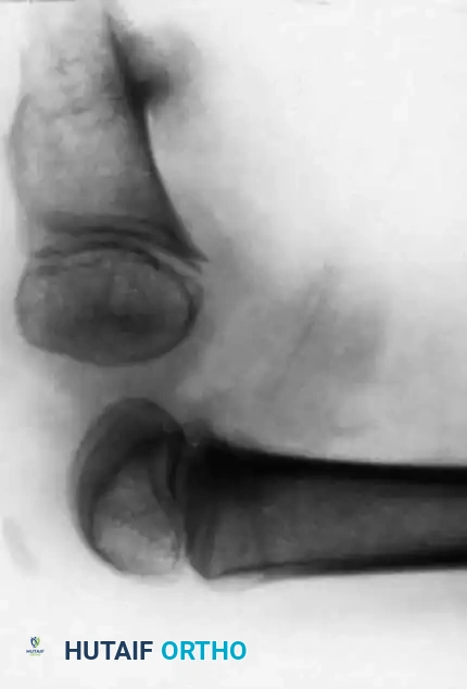 Hutaifortho's Orthopaedic Diagram