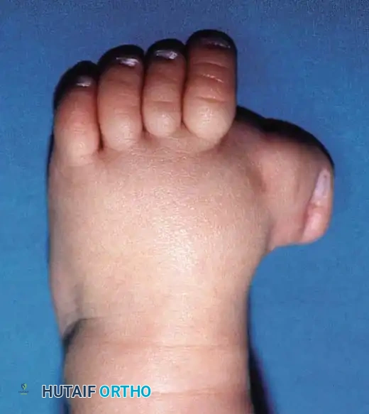 Preoperative Radiograph