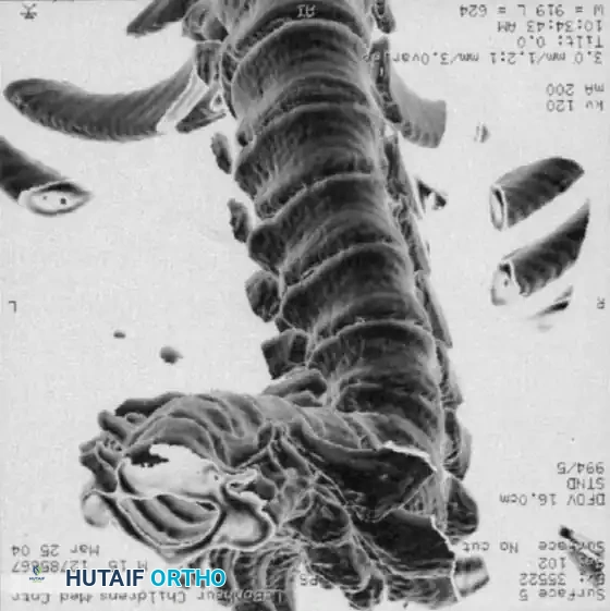 CT 3D Reconstruction C