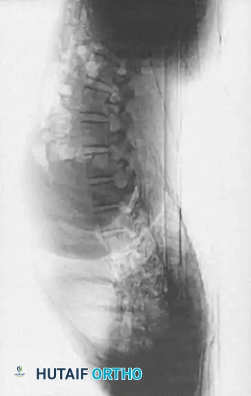 CT 3D Reconstruction B