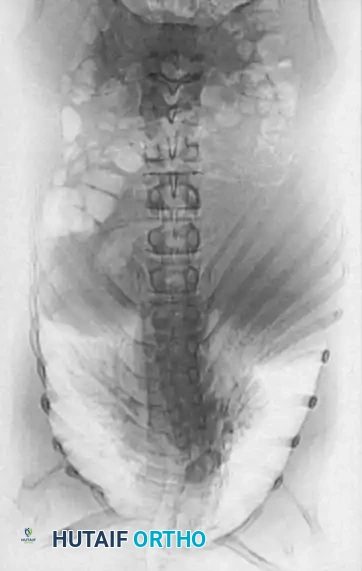 CT 3D Reconstruction A