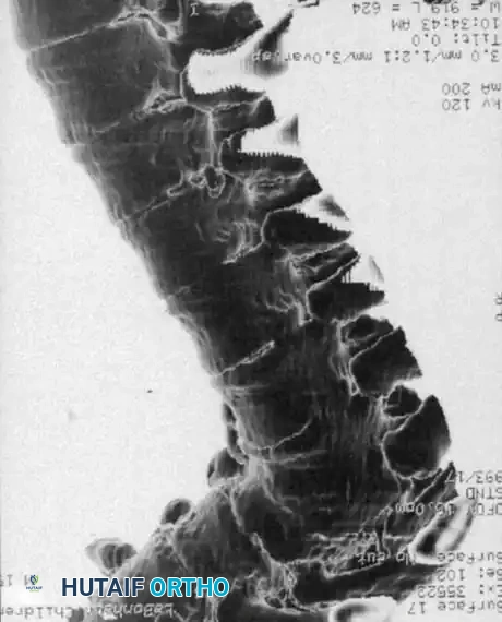 CT 3D Reconstruction E