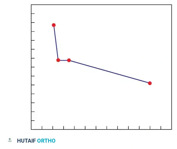 Surgical Diagram: Rod Contouring