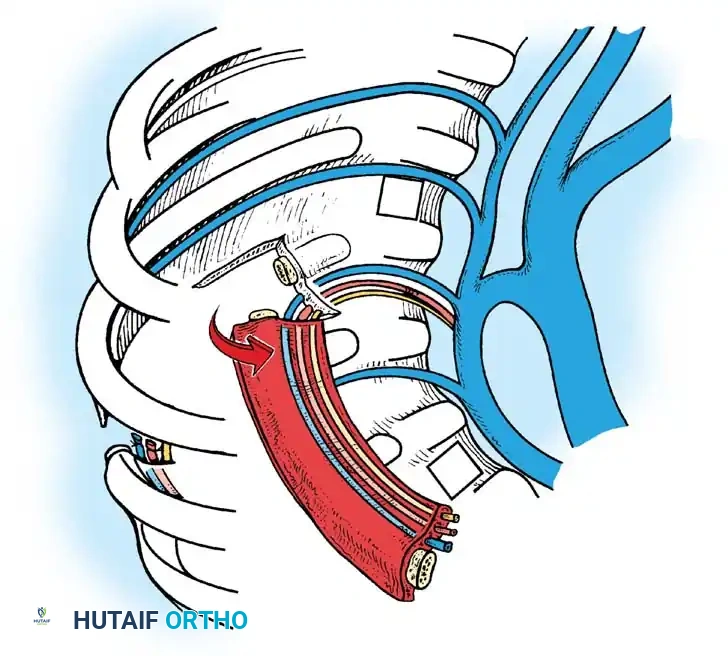 Surgical Diagram: Final Radiographic Check