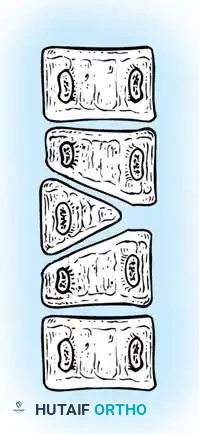 Hutaifortho's Orthopaedic Diagram