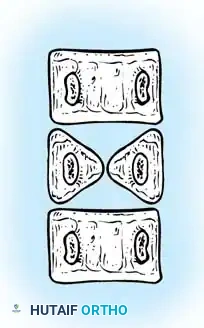 Hutaifortho's Orthopaedic Diagram
