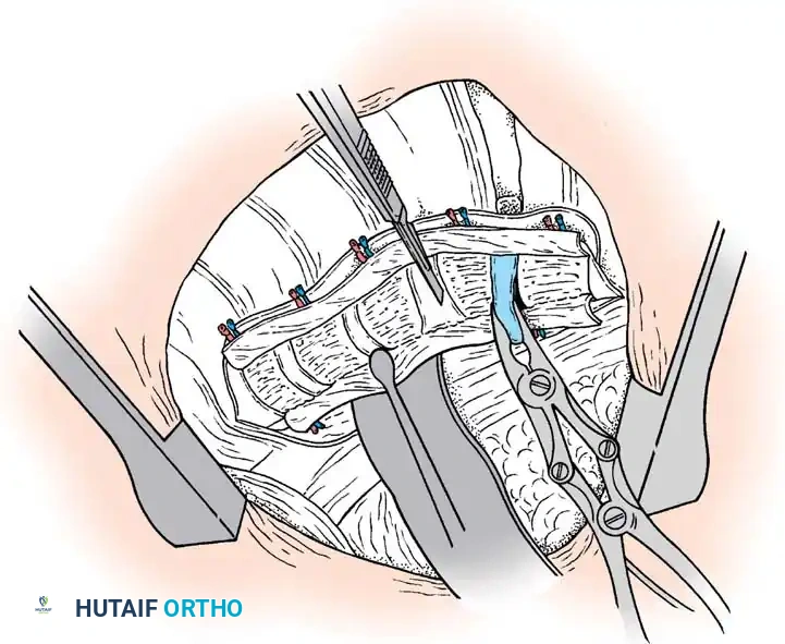 Hutaifortho's Orthopaedic Diagram