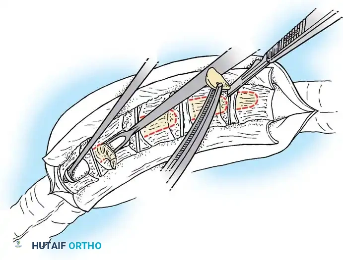 Hutaifortho's Orthopaedic Diagram