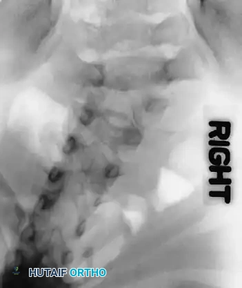 Hutaifortho's Orthopaedic Diagram