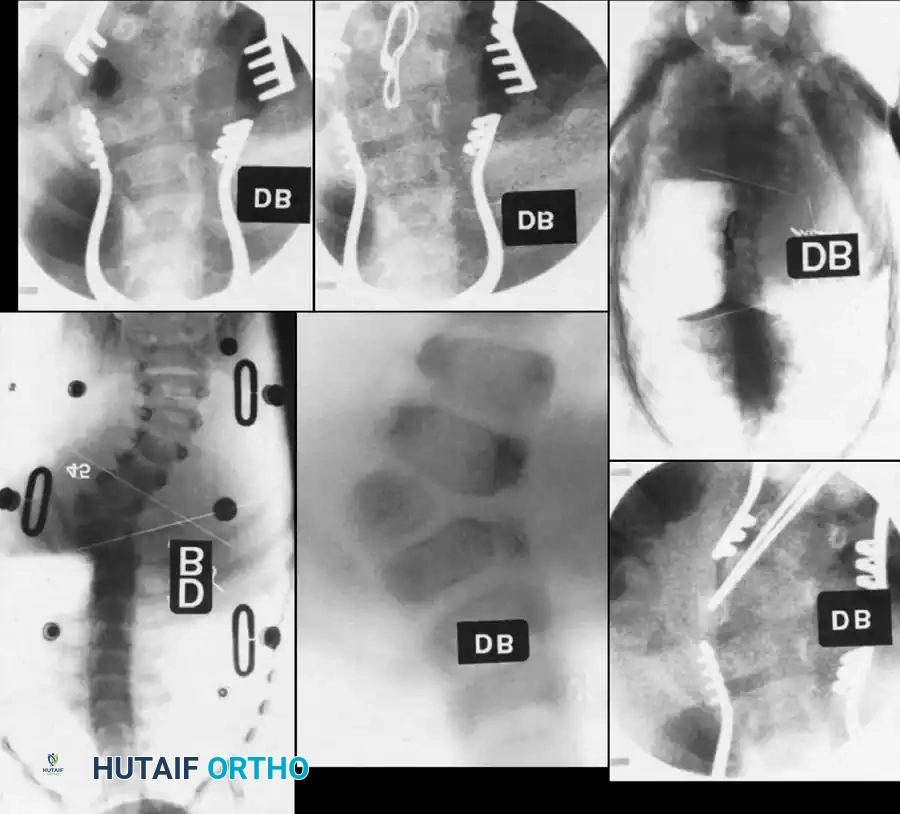 Hutaifortho's Orthopaedic Diagram