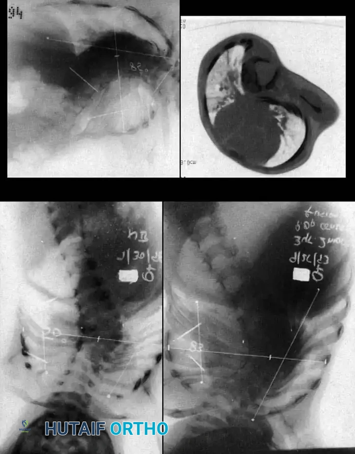 Hutaifortho's Orthopaedic Diagram