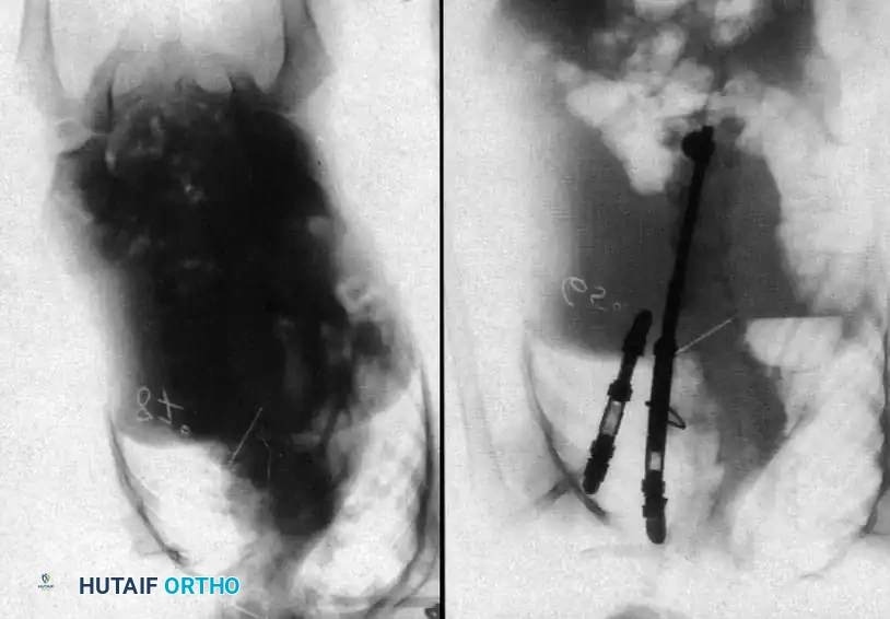 Hutaifortho's Orthopaedic Diagram