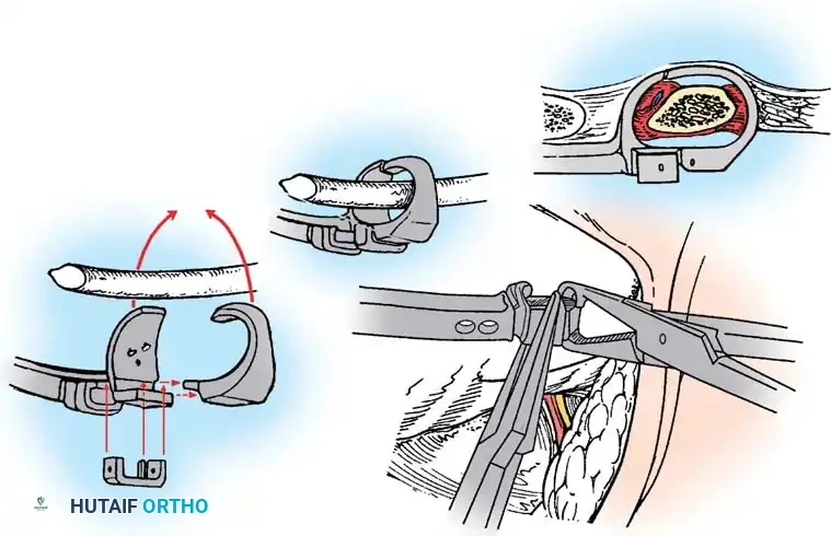 Hutaifortho's Orthopaedic Diagram