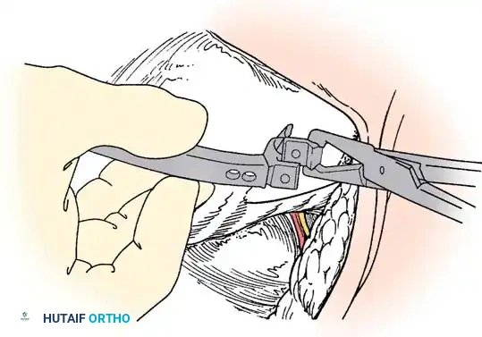 Hutaifortho's Orthopaedic Diagram
