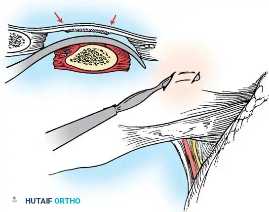Hutaifortho's Orthopaedic Diagram