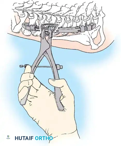 Hutaifortho's Orthopaedic Diagram