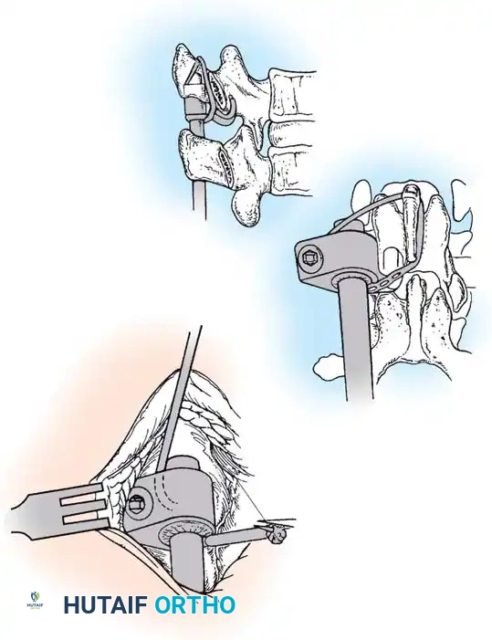 Hutaifortho's Orthopaedic Diagram