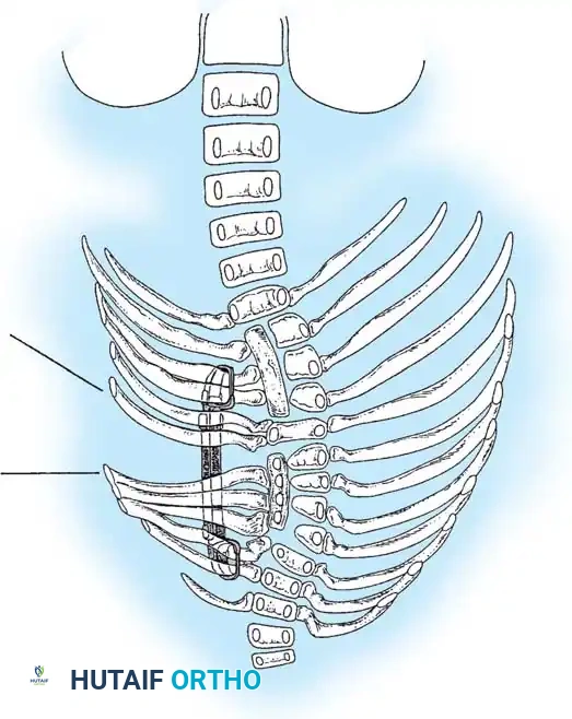 Hutaifortho's Orthopaedic Diagram