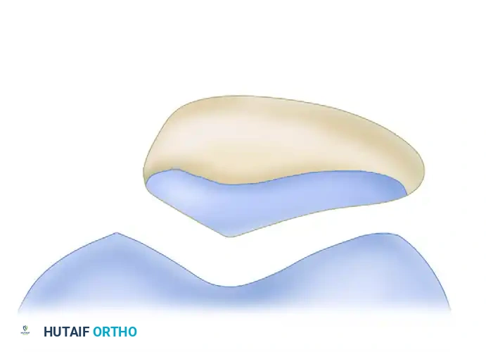 Measurements of patellofemoral congruence