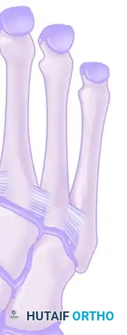 Lisfranc ligament (plantar structure)