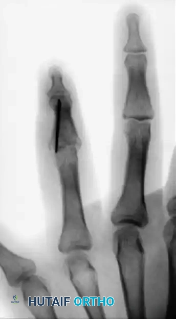 Hutaifortho's Orthopaedic Diagram