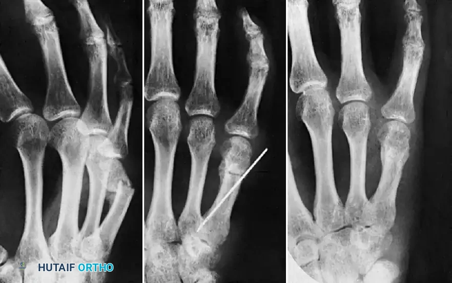 Hutaifortho's Orthopaedic Diagram