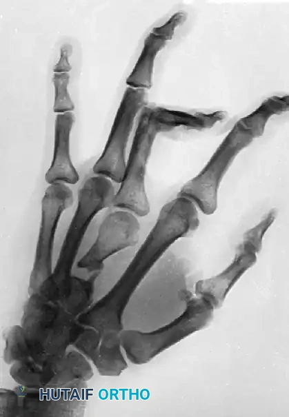 Hutaifortho's Orthopaedic Diagram