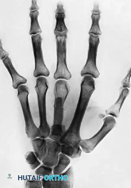 Hutaifortho's Orthopaedic Diagram