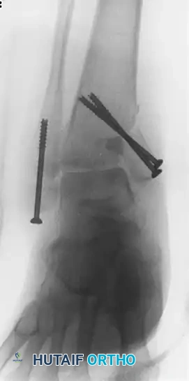 Hutaifortho's Orthopaedic Diagram