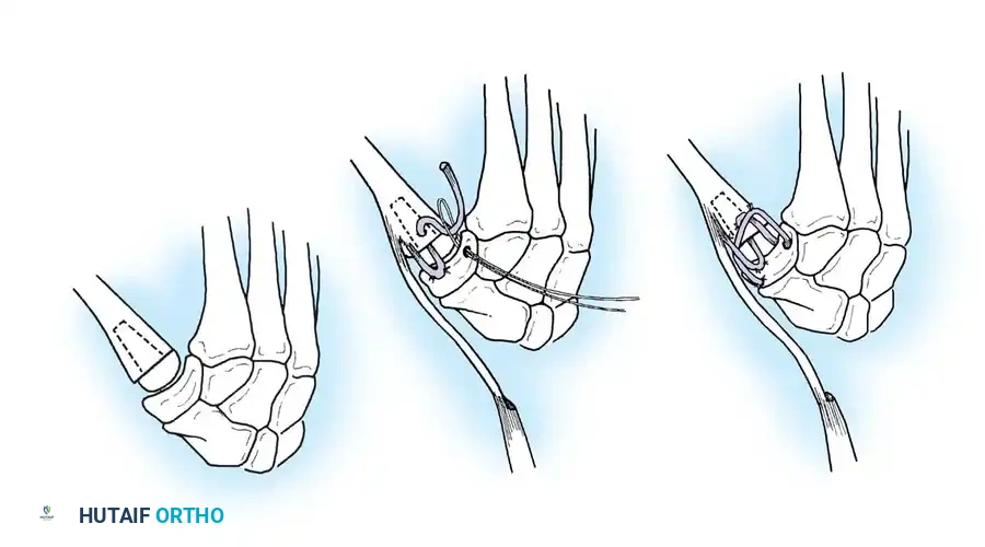 Hutaifortho's Orthopaedic Diagram