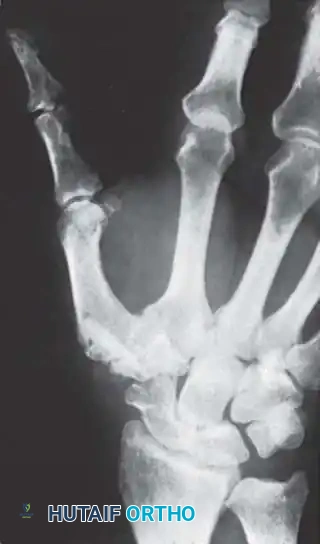 Hutaifortho's Orthopaedic Diagram