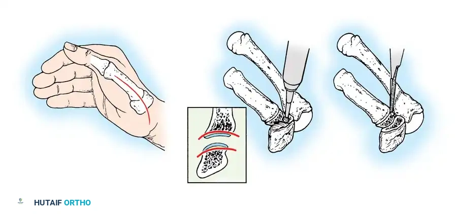 Hutaifortho's Orthopaedic Diagram