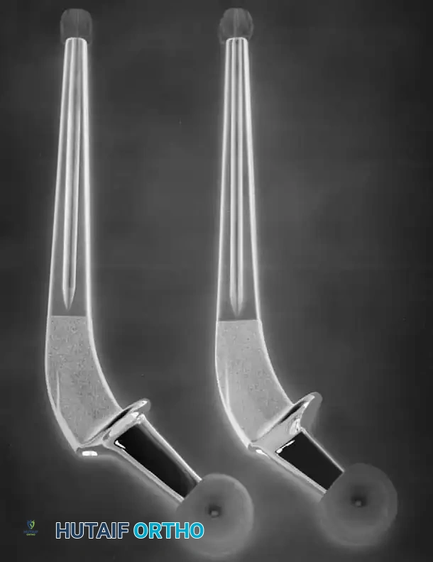 Hutaifortho's Orthopaedic Diagram