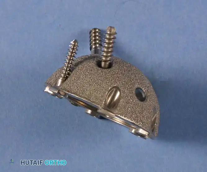 Hutaifortho's Orthopaedic Diagram