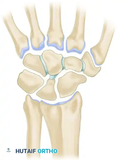 Mastering the Diagnosis and Management of Wrist Conditions