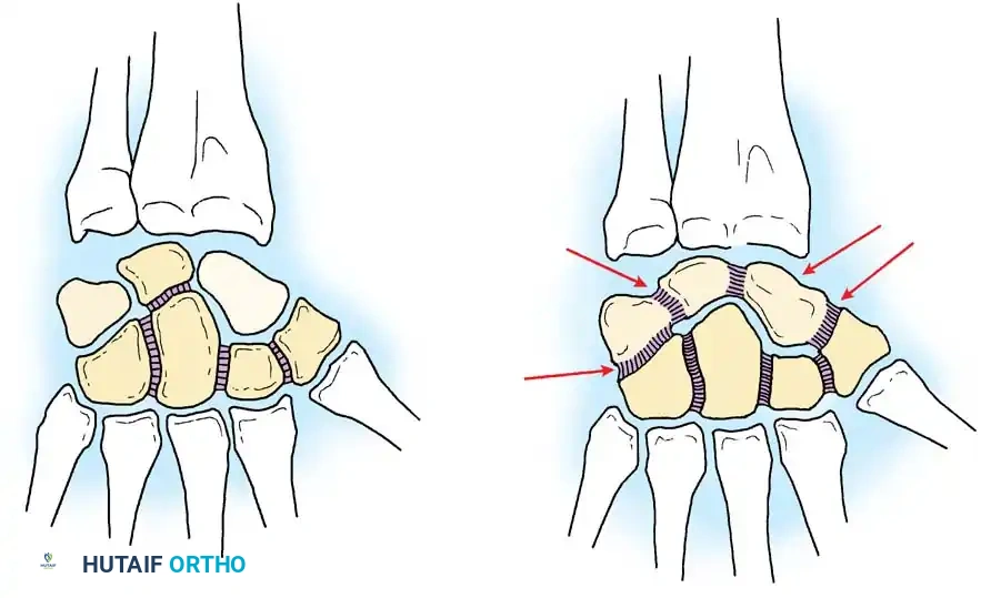 Comprehensive Diagnosis of Wrist Conditions: An Evidence-Based Orthopaedic Guide