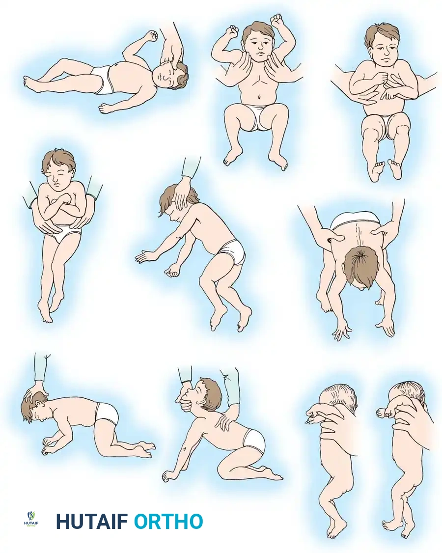 Cerebral Palsy: Comprehensive Diagnosis, Prognostic Evaluation, and Gait Analysis