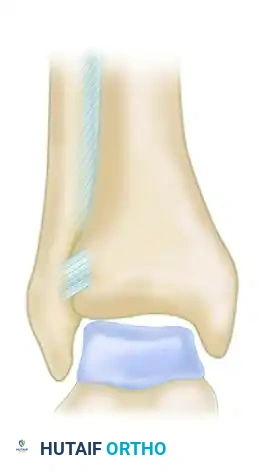 DIAGNOSIS Surgical Diagram