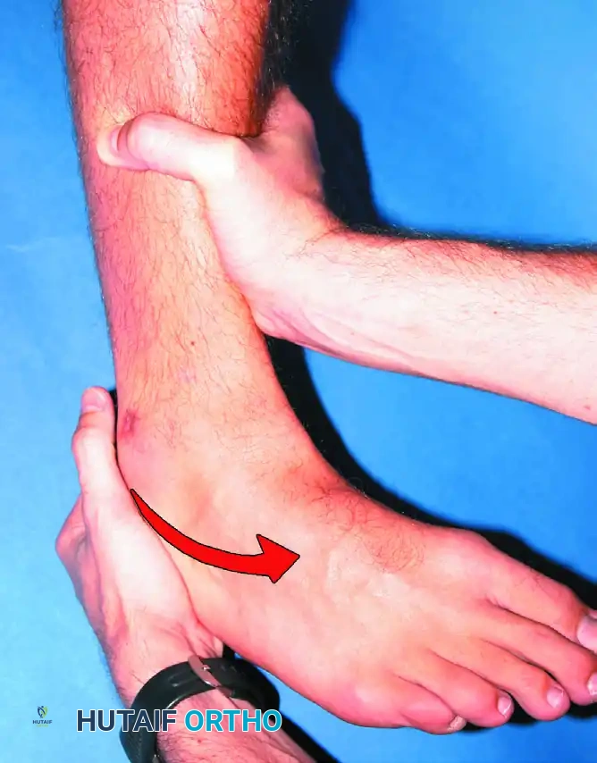 DIAGNOSIS Surgical Diagram