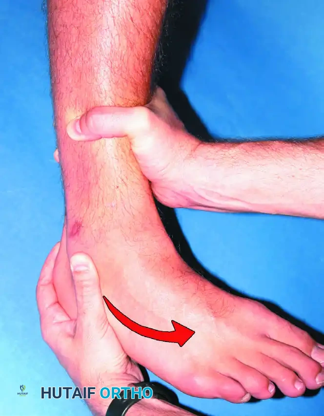 DIAGNOSIS Surgical Diagram