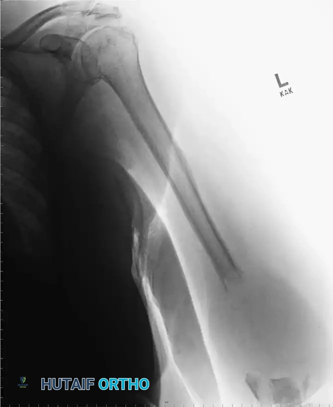 Mastering the Diagnosis and Surgical Management of Musculoskeletal Infections