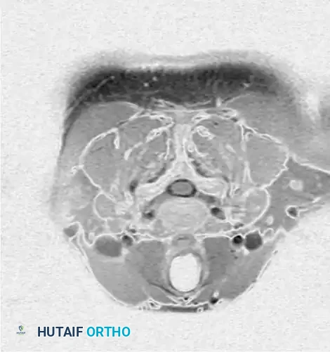 DIAGNOSTIC STUDIES Surgical Diagram