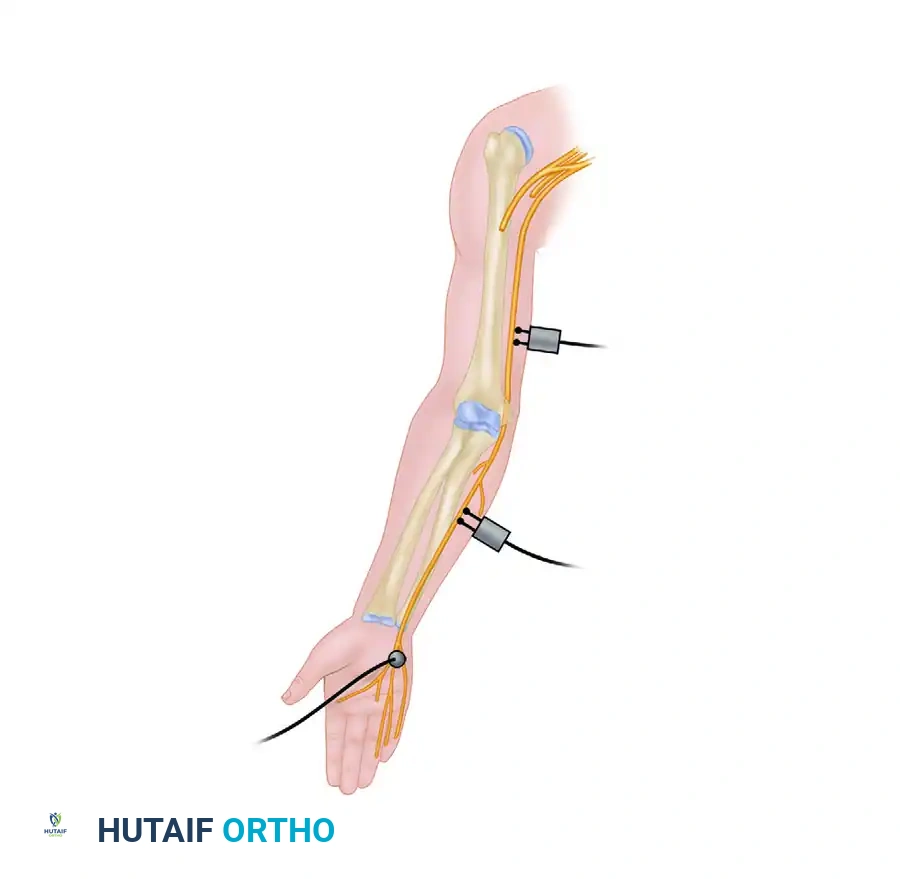Diagnostic Modalities and Surgical Timing in Peripheral Nerve Injuries