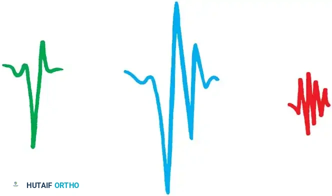 Differentiating Muscle from Nerve Disease: A Comprehensive Orthopaedic Guide