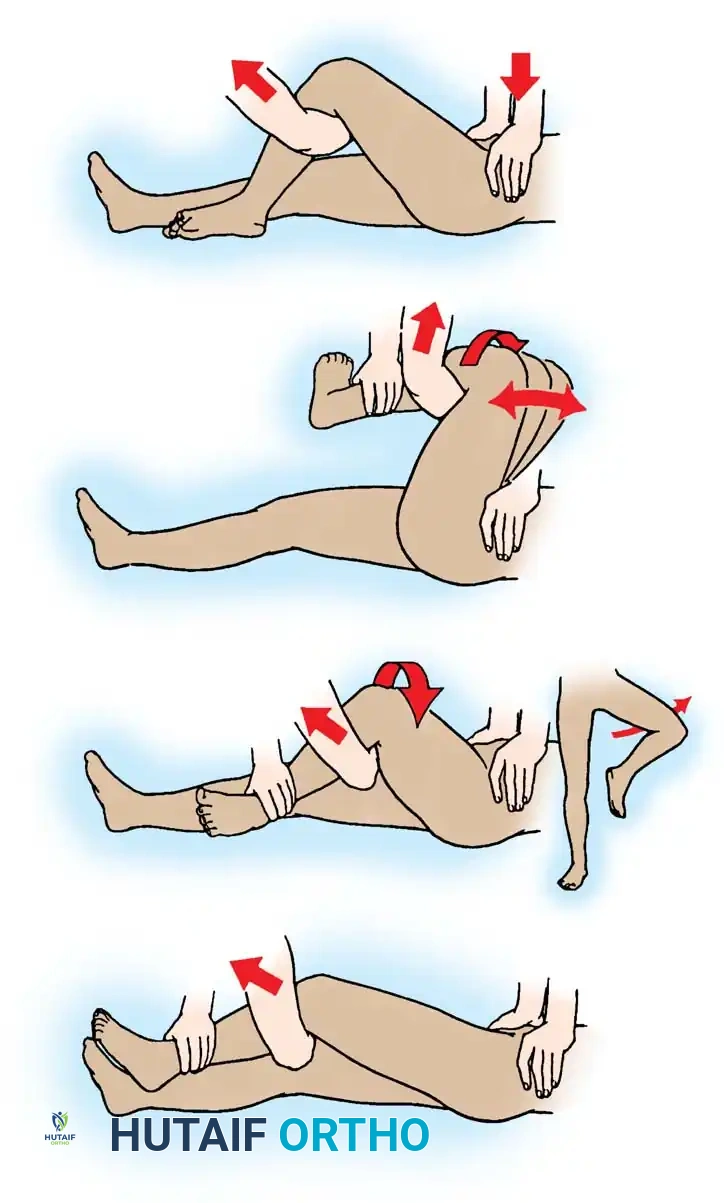DISLOCATION AND FRACTUREDISLOCATION OF THE HIP Surgical Diagram