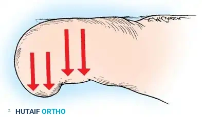 Disorders of Nails and Skin Surgical Diagram